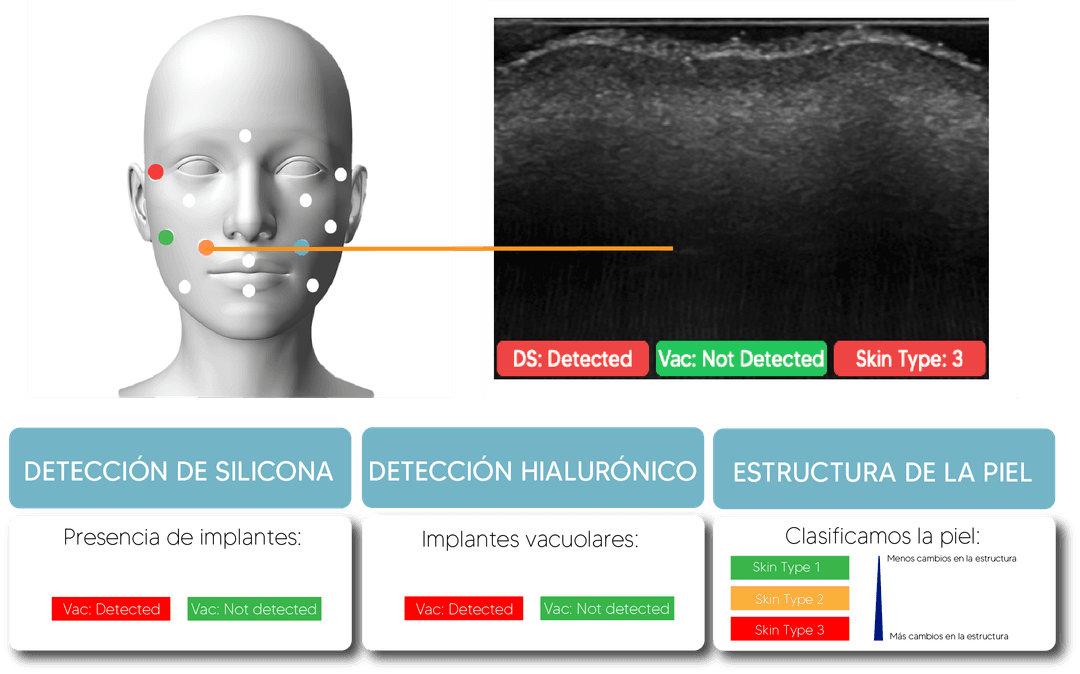 Detección de implantes con Nesai FACE